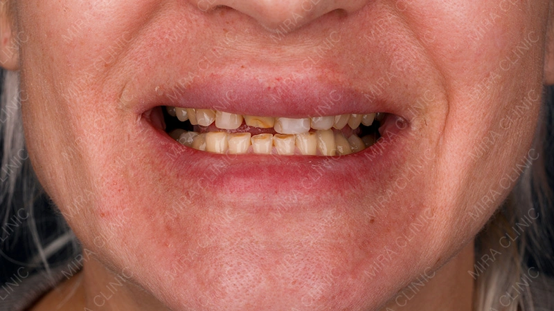 negative experience in dental care